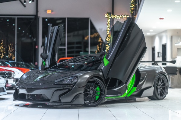 Used-2016-McLaren-570S-Coupe-MSRP-274K-60K-in-UPGRADES--VORSTEINER-BODY-KIT